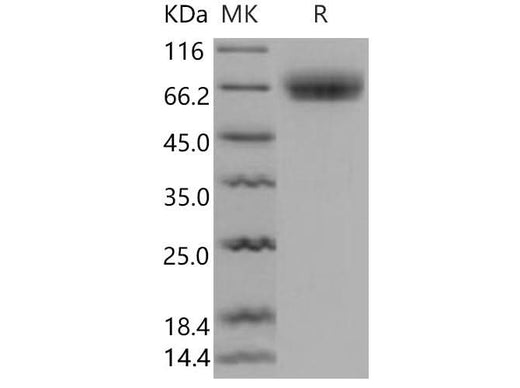 > 96 % as determined by reducing SDS-PAGE.