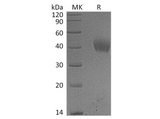 Recombinant Human IL-20RA/IL-20R1 Protein (His Tag) - ABMIUM