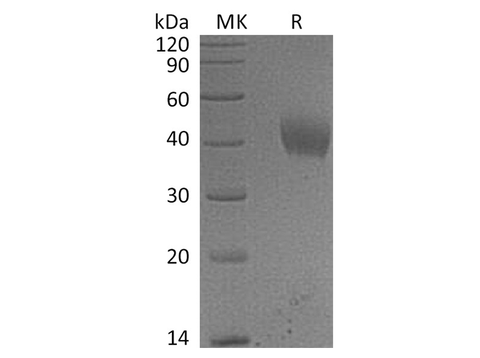 Recombinant Human IL-20RA/IL-20R1 Protein (His Tag) - ABMIUM
