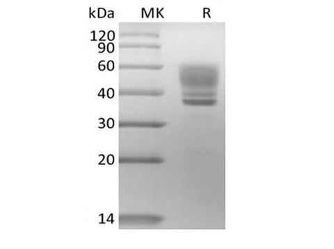 Recombinant Human Interleukin-13/IL-13 (C-mFc) - ABMIUM