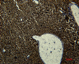 Anti-Human Transferrin Antibody [1B12] - ABMIUM