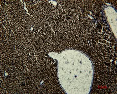 Anti-Human Transferrin Antibody [1B12] - ABMIUM