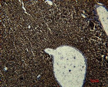 Anti-Human Transferrin Antibody [1B12] - ABMIUM