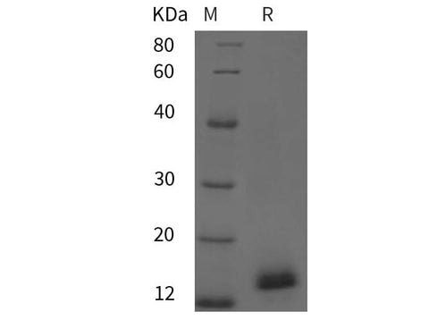 SDS-PAGE analysis of Chicken IL2/IL-2/Interleukin-2 proteins, 2 μg/lane of Recombinant Chicken IL2/IL-2/Interleukin-2 proteins was resolved with SDS-PAGE under reducing conditions, showing bands at 14 kDa.