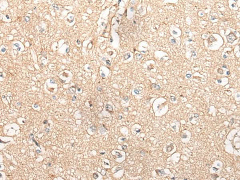 Immunohistochemistry of paraffin-embedded Human brain tissue using MTNR1B Polyclonal Antibody at dilution of 1:55(×200)