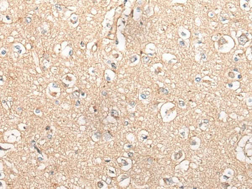 Immunohistochemistry of paraffin-embedded Human brain tissue using MTNR1B Polyclonal Antibody at dilution of 1:55(×200)