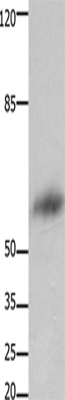 Anti-Human/Mouse/Rat FOXJ3 Antibody - ABMIUM