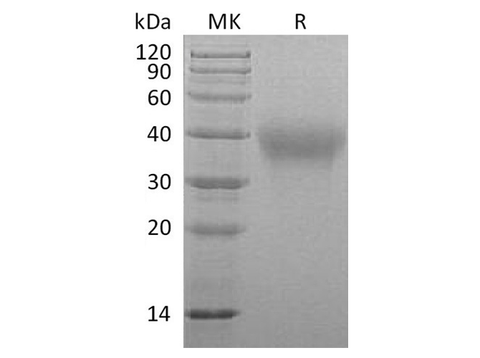 Recombinant Marmoset TIM-3/HAVCR2 Protein (His Tag) - ABMIUM