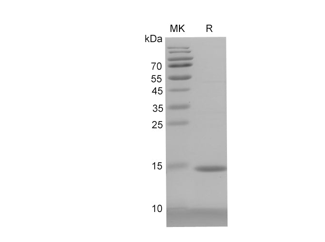 SDS-PAGE analysis of Human Lamin B1 proteins, 2 μg/lane of Recombinant Human Lamin B1 proteins was resolved with SDS-PAGE under reducing conditions, showing bands at 14 kDa.