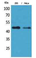 Anti-Human/Mouse/Rat IDH1 Antibody
