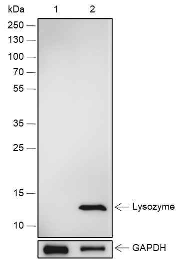 Anti-Human Lysozyme Antibody [A580] - ABMIUM