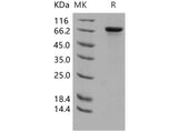 Recombinant Human HPRG/HRG Protein (His Tag) - ABMIUM