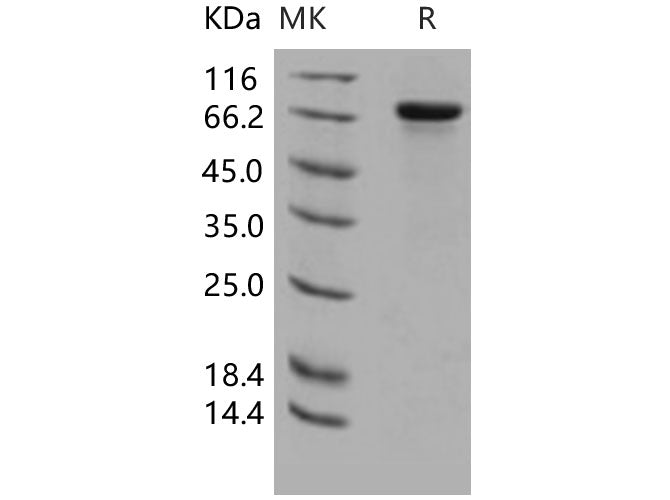 Recombinant Human HPRG/HRG Protein (His Tag) - ABMIUM