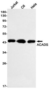 Western blot detection of ACADS in Jurkat,C6,Hela cell lysates using ACADS Rabbit mAb(1:1000 diluted).Predicted band size:44kDa.Observed band size:44kDa.