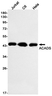 Western blot detection of ACADS in Jurkat,C6,Hela cell lysates using ACADS Rabbit mAb(1:1000 diluted).Predicted band size:44kDa.Observed band size:44kDa.