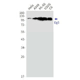 Western blot detection of Eg5 in Hela,A549,HL-60,U2OS,C6 cell lysates using Eg5 Rabbit mAb(1:1000 diluted).Predicted band size:119kDa.Observed band size:119kDa.