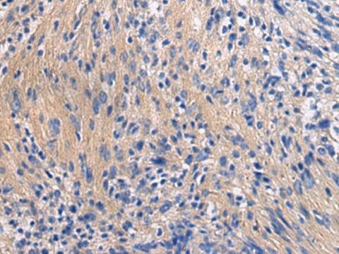 Immunohistochemistry of paraffin-embedded Human brain tissue using GALR3 Polyclonal Antibody at dilution of 1:50(×200)