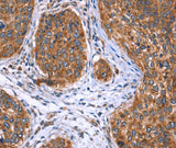 Anti-Human EVC2 Antibody - ABMIUM