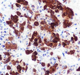 Anti-Human/Rat ACTH Antibody [A681]