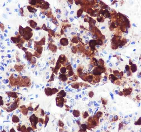 Anti-Human/Rat ACTH Antibody [A681] - ABMIUM