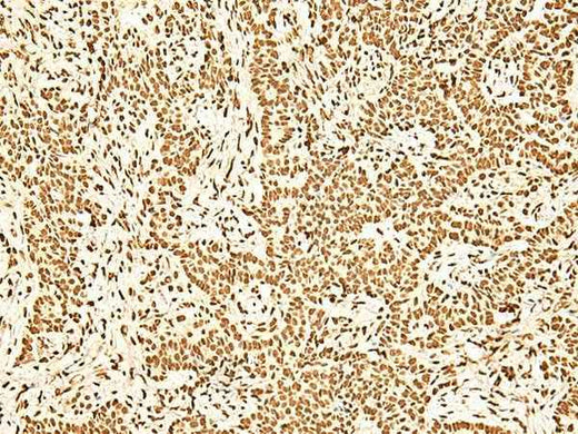 Anti-Human/Mouse/Rat ILF3 Antibody