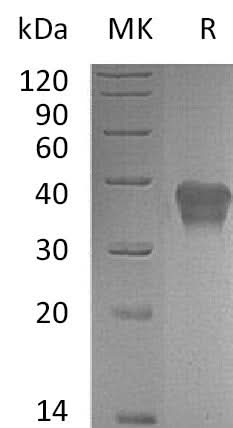 Recombinant Mouse TSLP Receptor/CRLF2 Protein (His Tag) - ABMIUM
