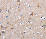 Anti-Human/Mouse/Rat FN1 Antibody - ABMIUM