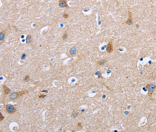 Anti-Human/Mouse/Rat FN1 Antibody - ABMIUM