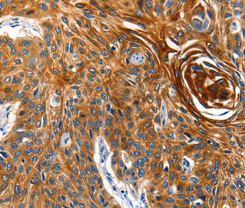 Anti-Human AQP5 Antibody - ABMIUM