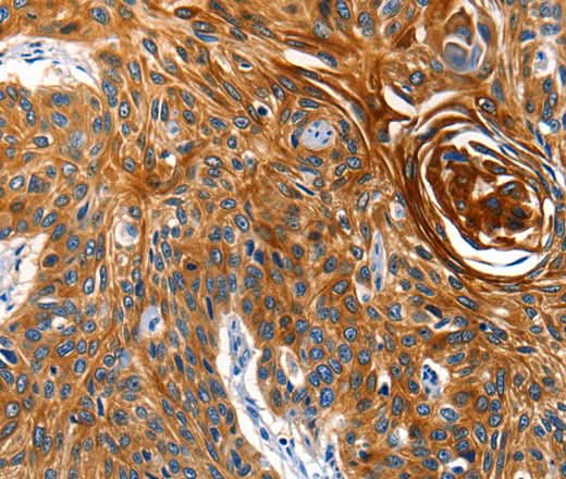 Anti-Human AQP5 Antibody - ABMIUM
