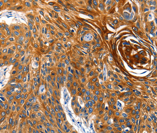 Anti-Human AQP5 Antibody - ABMIUM