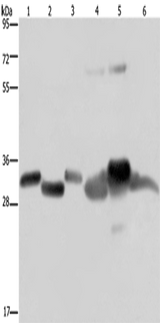 Anti-Human/Mouse/Rat HMGCL Antibody - ABMIUM