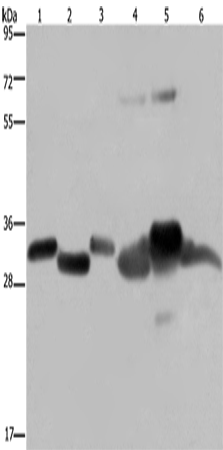 Anti-Human/Mouse/Rat HMGCL Antibody - ABMIUM