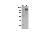SDS-PAGE analysis of Rat ACE2 proteins, 2 μg/lane of Recombinant Rat ACE2 proteins was resolved with SDS-PAGE under reducing conditions, showing bands at 80-90 kDa.