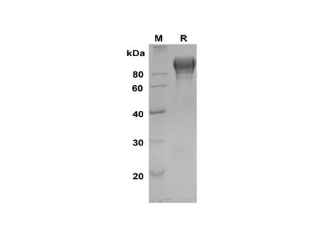 SDS-PAGE analysis of Rat ACE2 proteins, 2 μg/lane of Recombinant Rat ACE2 proteins was resolved with SDS-PAGE under reducing conditions, showing bands at 80-90 kDa.