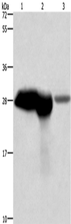 Anti-Human/Mouse/Rat CALB1 Antibody - ABMIUM