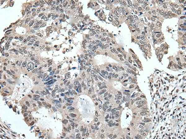 Anti-Human/Mouse/Rat TRIM23 Antibody