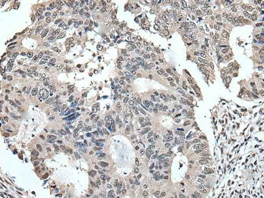 Anti-Human/Mouse/Rat TRIM23 Antibody