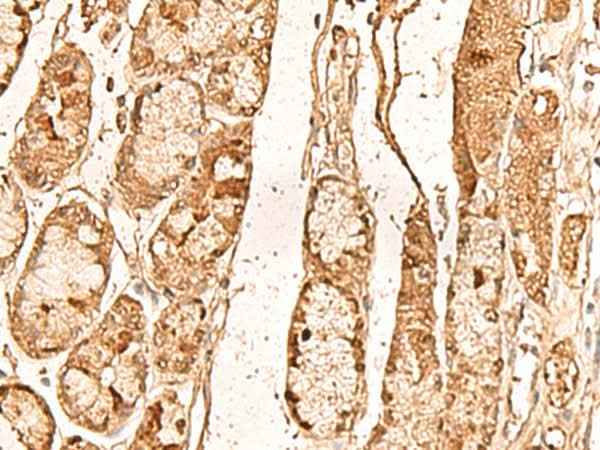 Anti-Human/Mouse WDR33 Antibody