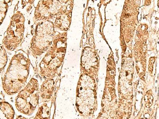 Anti-Human/Mouse WDR33 Antibody