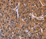 Anti-Human/Mouse NFATC3 Antibody - ABMIUM