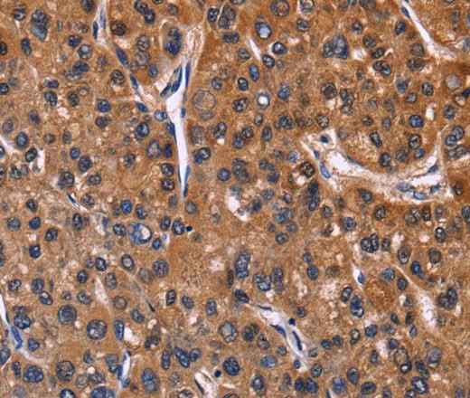 Anti-Human/Mouse NFATC3 Antibody