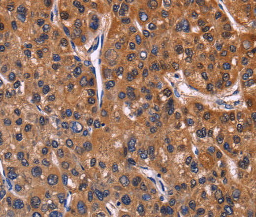Anti-Human/Mouse NFATC3 Antibody - ABMIUM