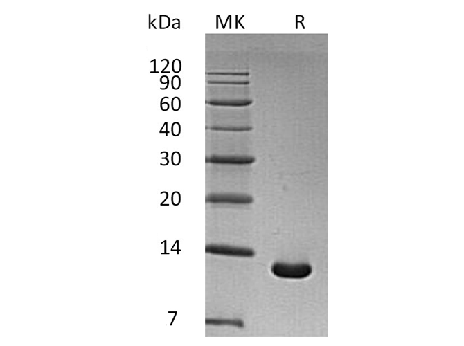 Recombinant Human S100A6 Protein (E.coli, His Tag) - ABMIUM