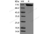 Recombinant Mouse ANPEP/CD13 Protein (His Tag) - ABMIUM