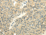 Anti-Human/Mouse/Rat UBL4A Antibody - ABMIUM