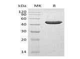 Recombinant Human INPP5A Protein (His Tag) - ABMIUM