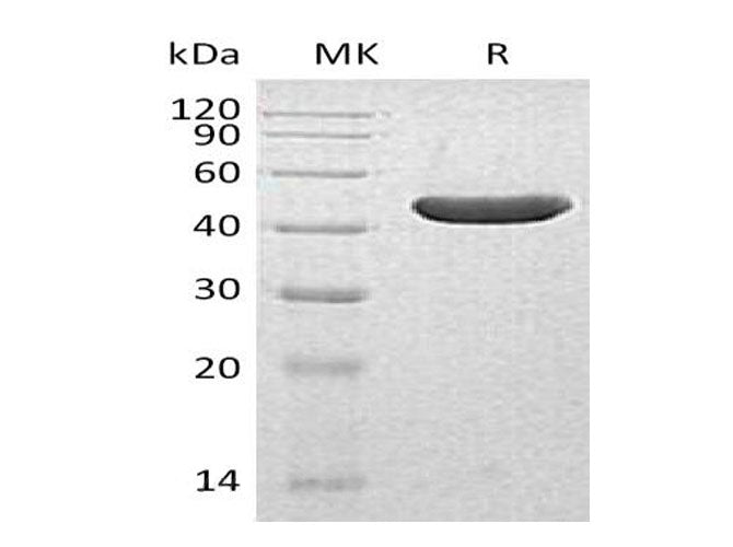 Recombinant Human INPP5A Protein (His Tag) - ABMIUM