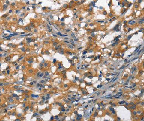 Anti-Human/Mouse DDR2 Antibody