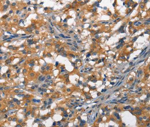 Anti-Human/Mouse DDR2 Antibody